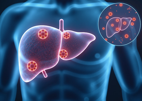 判断 HBV 感染病毒复制水平