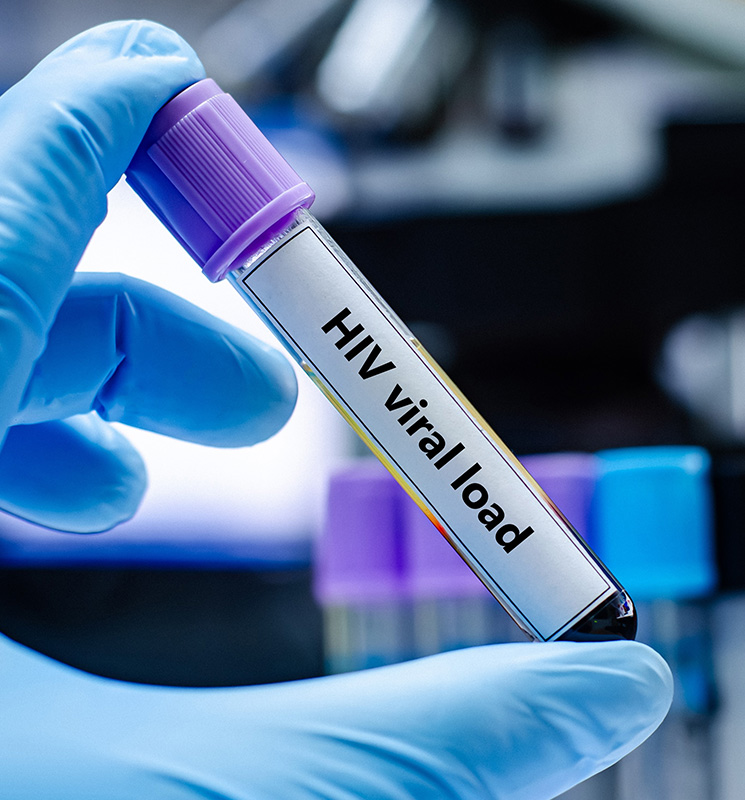 HIV-1基因型耐药检测